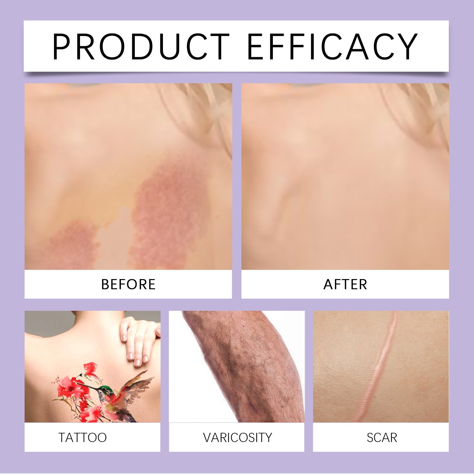 EELHOE Body Coverage Perfector Waterproof Body Concealer, Full Coverage Hide Tattoos Scars Varicose Veins, Long Lasting Even Skin Tone Body Foundation For Face & Body 74ml