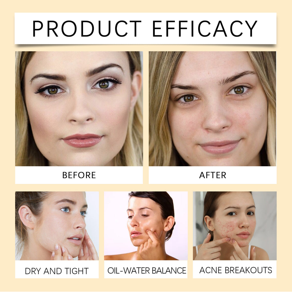 EELHOE Centella Asiatica Cleansing Oil, Gentle Makeup Remover Oil Rapid Emulsifying Deep Clean Soothing For Sensitive Skin